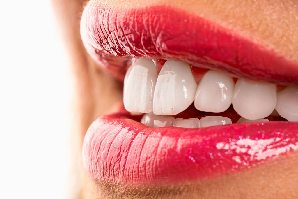 Ce trebuie sa stii despre alegerea si aplicarea fatetelor dentare?